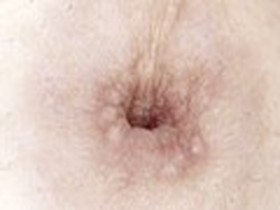 300人の乳首 第1集　サンプル画像08